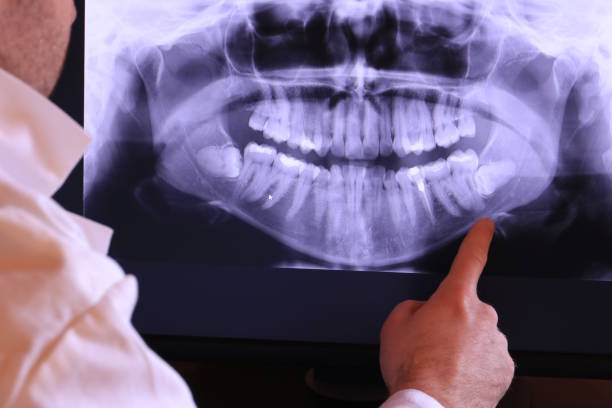 Best Emergency Tooth Extraction in North Platte, NE
