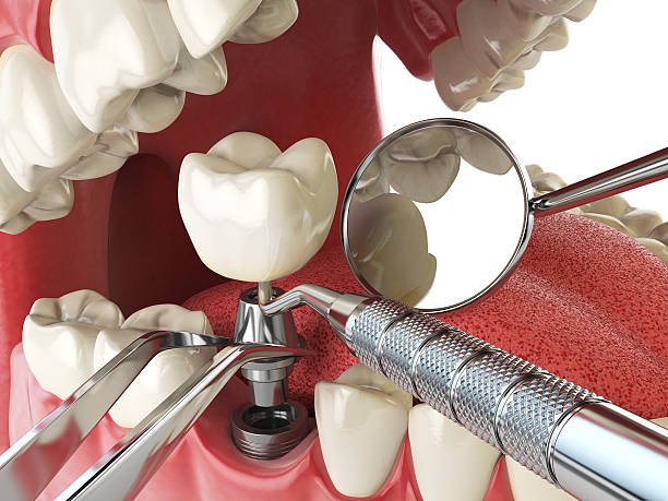 Best Emergency Dental Care for Trauma or Injury in North Platte, NE