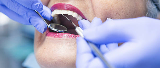Best Emergency Broken Tooth Repair in North Platte, NE